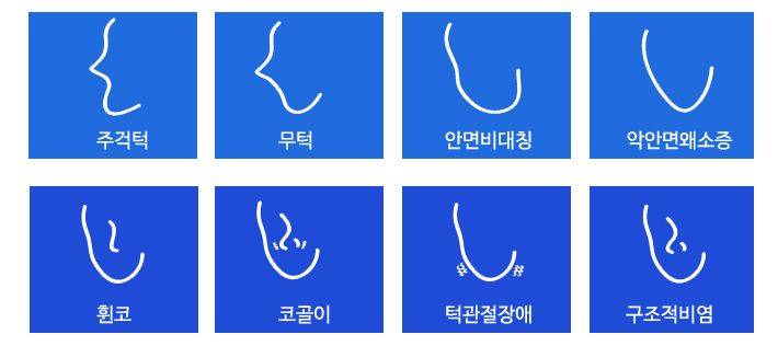 안면비대칭과 턱·얼굴 형태의 여러 양상을 설명하는 그림
