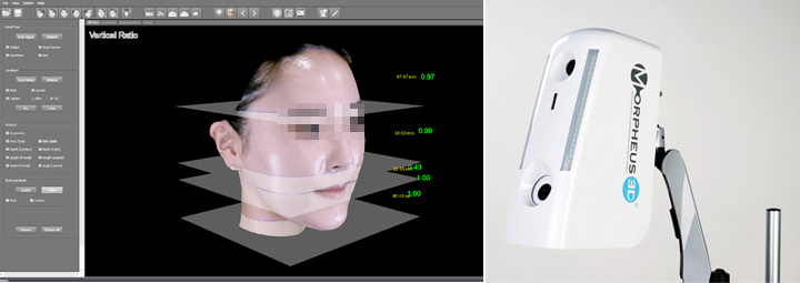 Morpheus 3D 얼굴 분석 장비와 촬영 화면